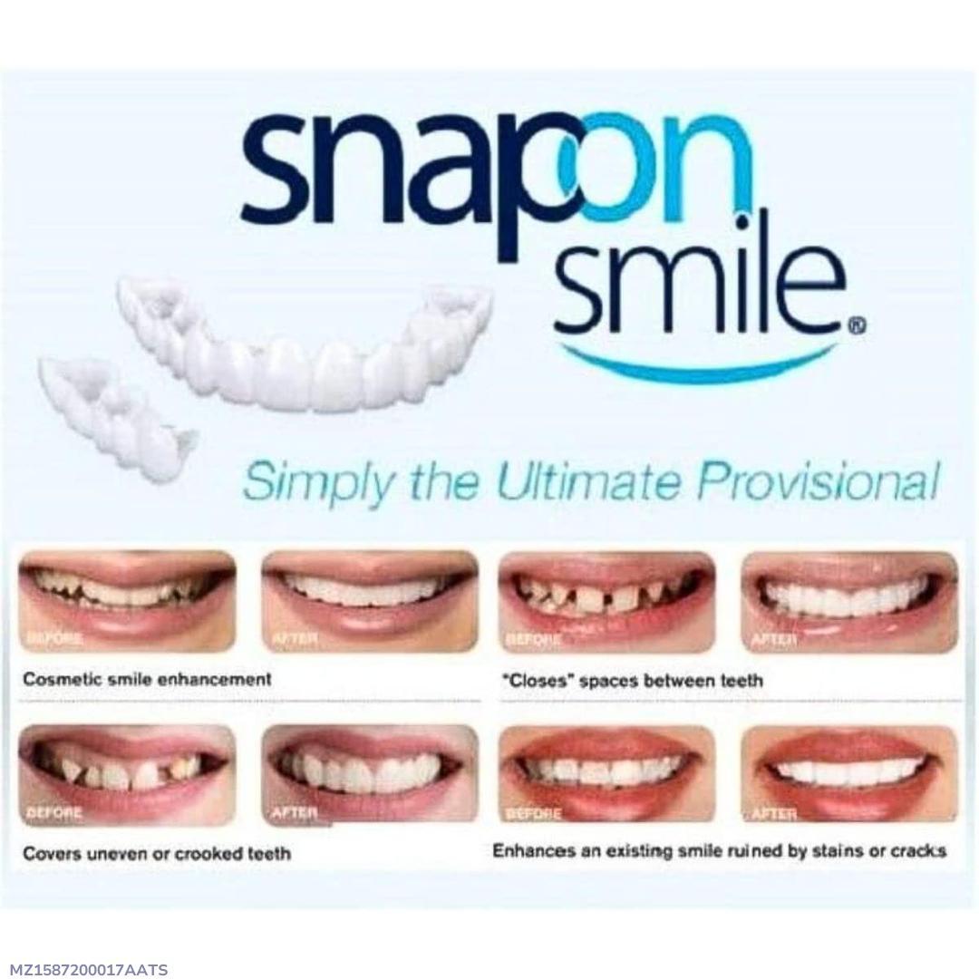 Snap Teeth Covers – Natural Look, Instant Smile Upgrade