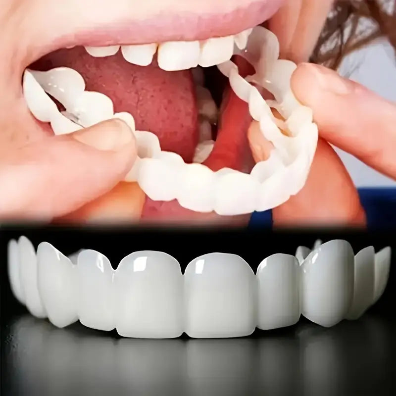Snap Teeth Covers – Natural Look, Instant Smile Upgrade