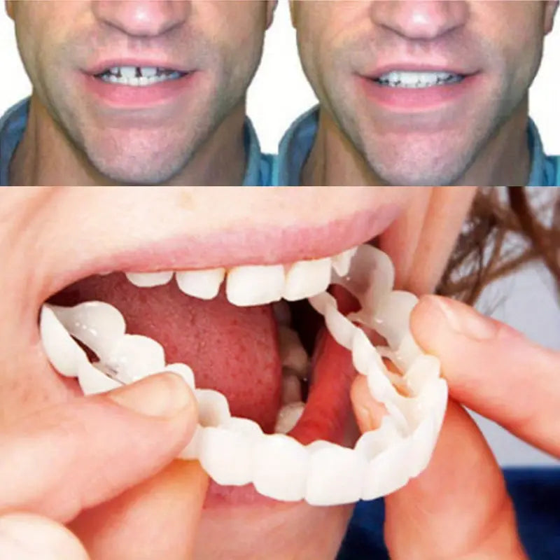 Snap Teeth Covers – Natural Look, Instant Smile Upgrade